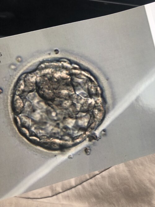 Close-up of a human embryo at the blastocyst stage on a laboratory dish.