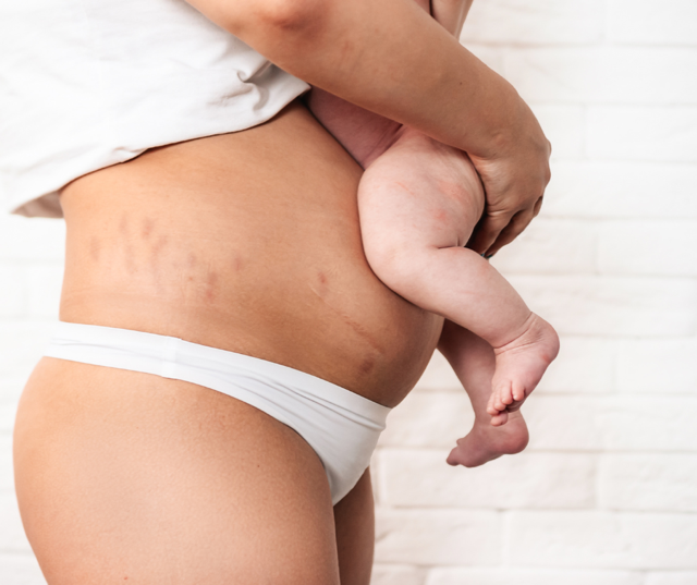 The 4th Trimester: Why Postpartum Care Matters