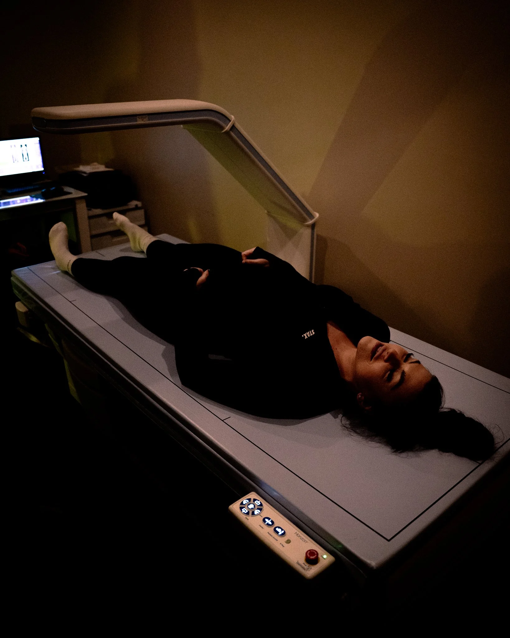 DEXA SCAN