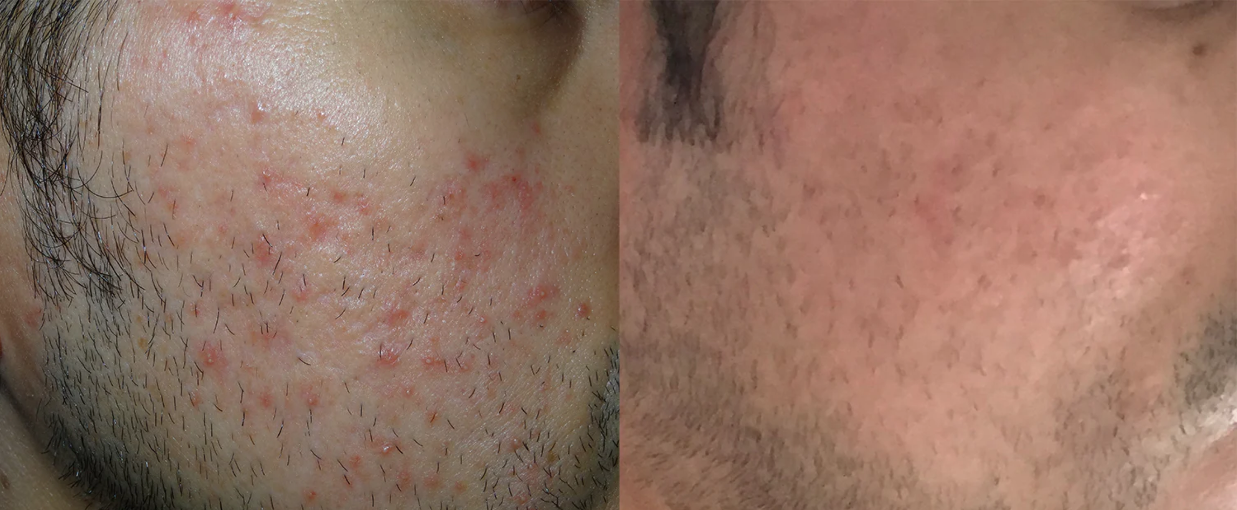 Screen Shot 2024-04-11 at 6.01.44 pm.png