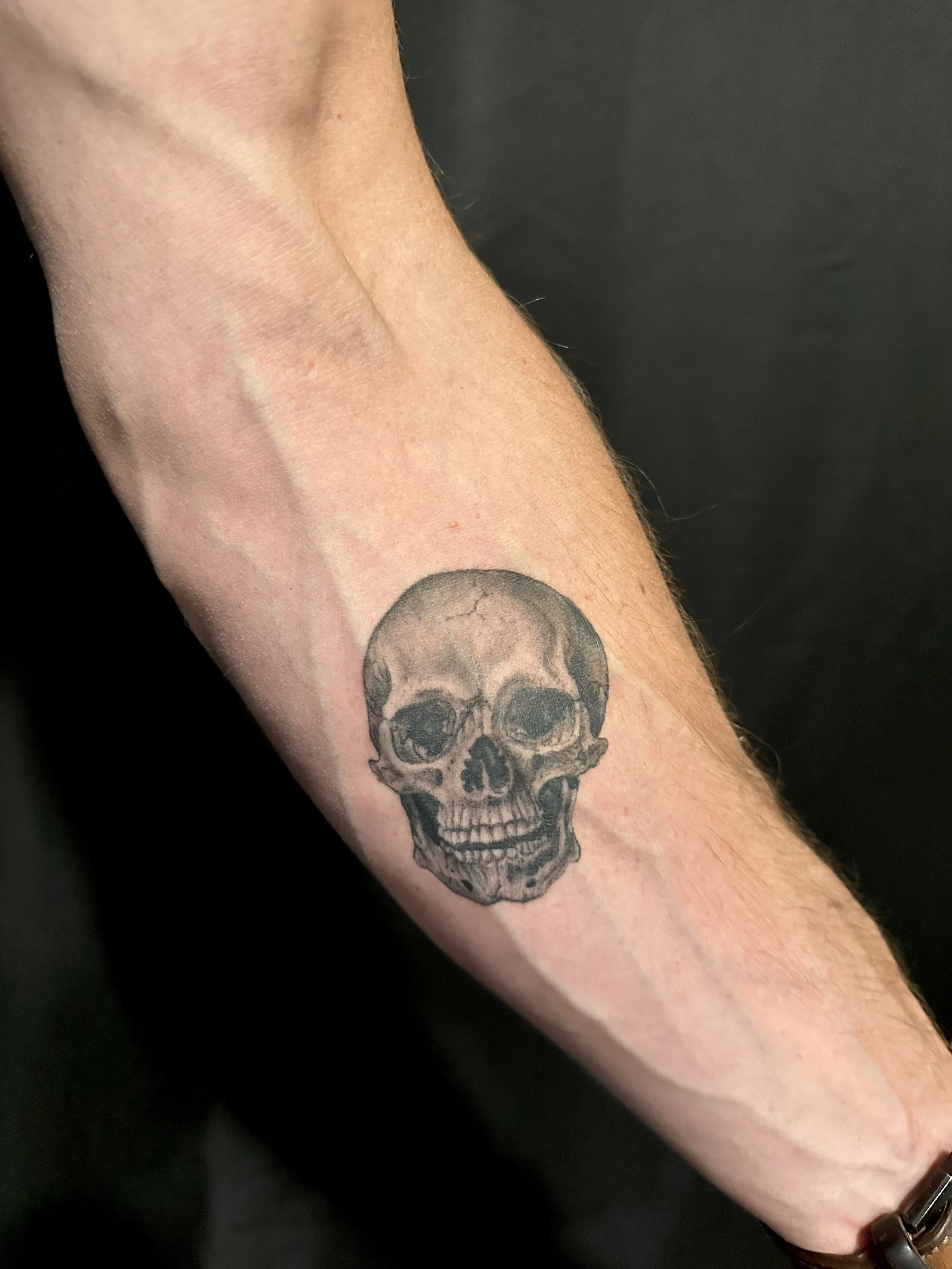 Healed Skull.jpg