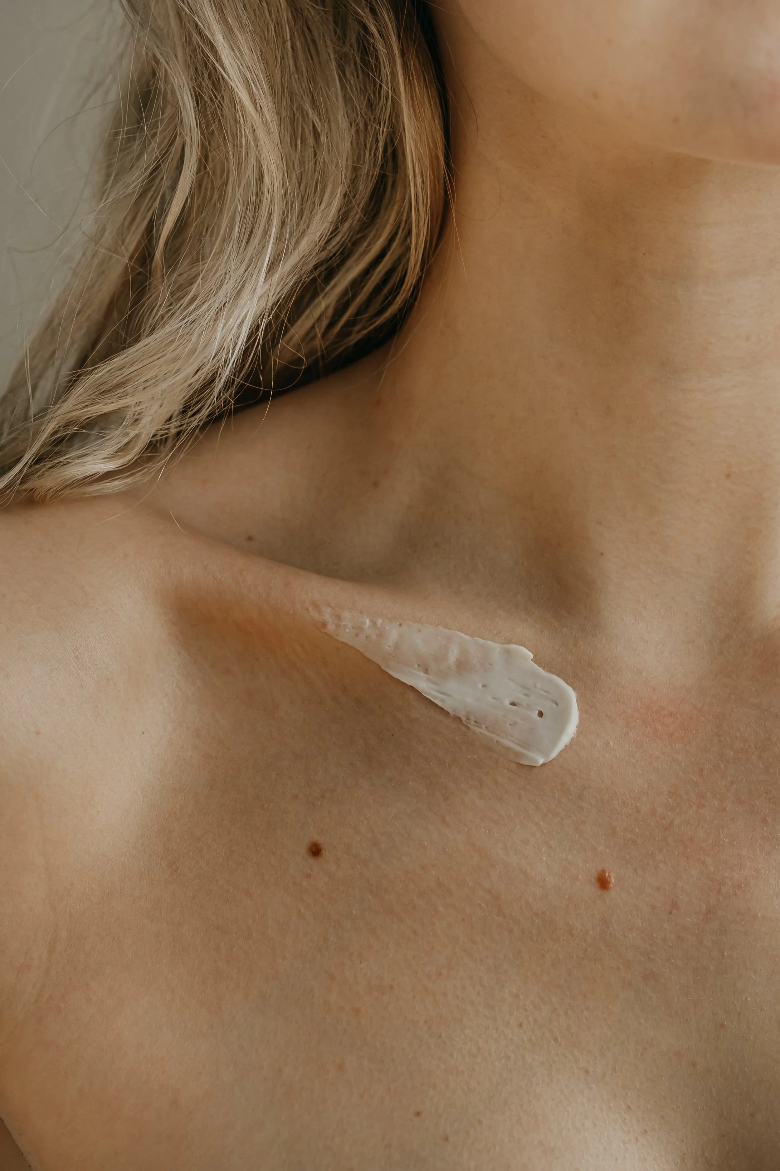 Eczema and Skin Conditions