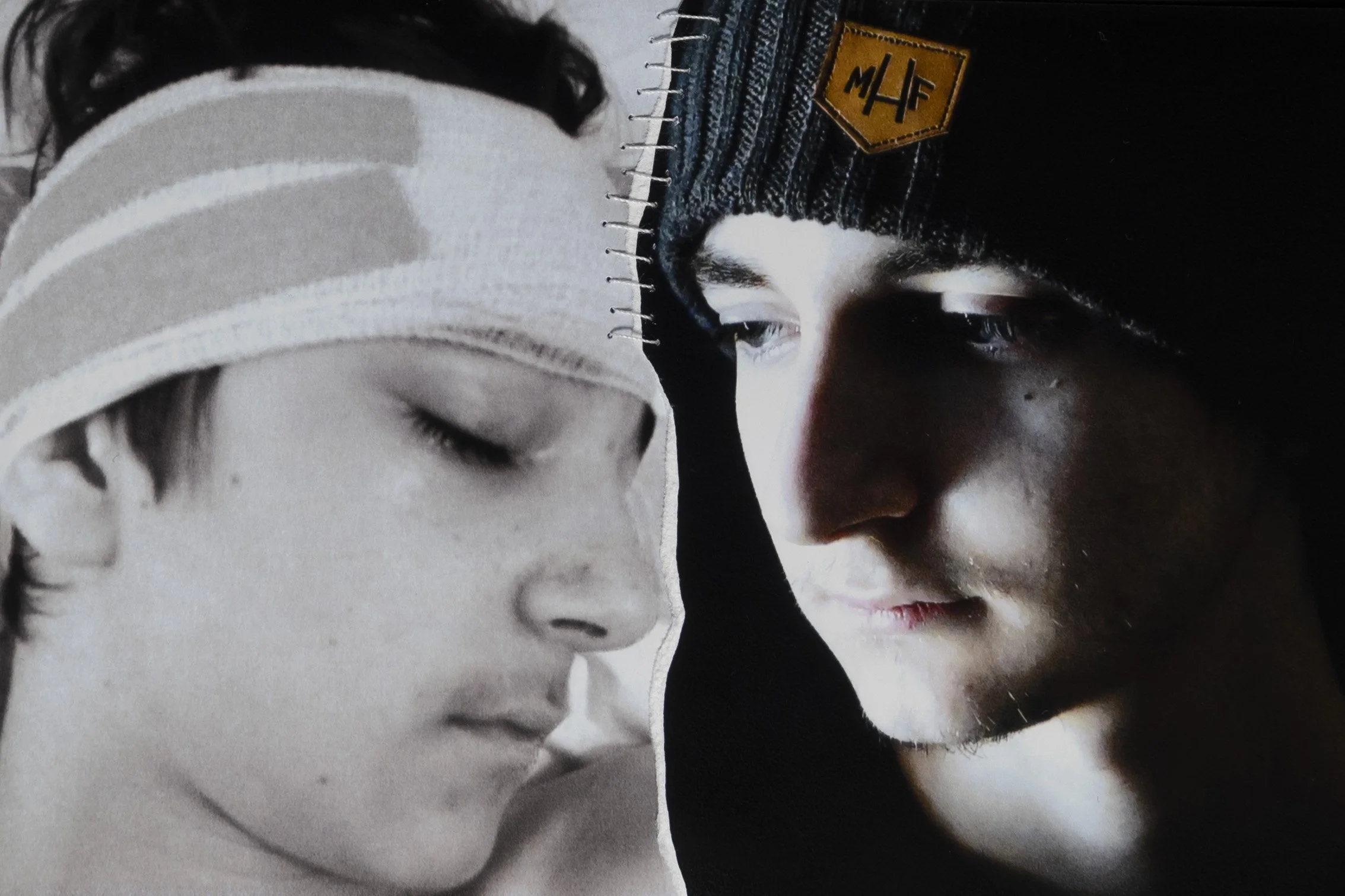 2. Stitched
Brain surgery, I had just turned 13 and life as I knew it felt like it had been ripped apart.