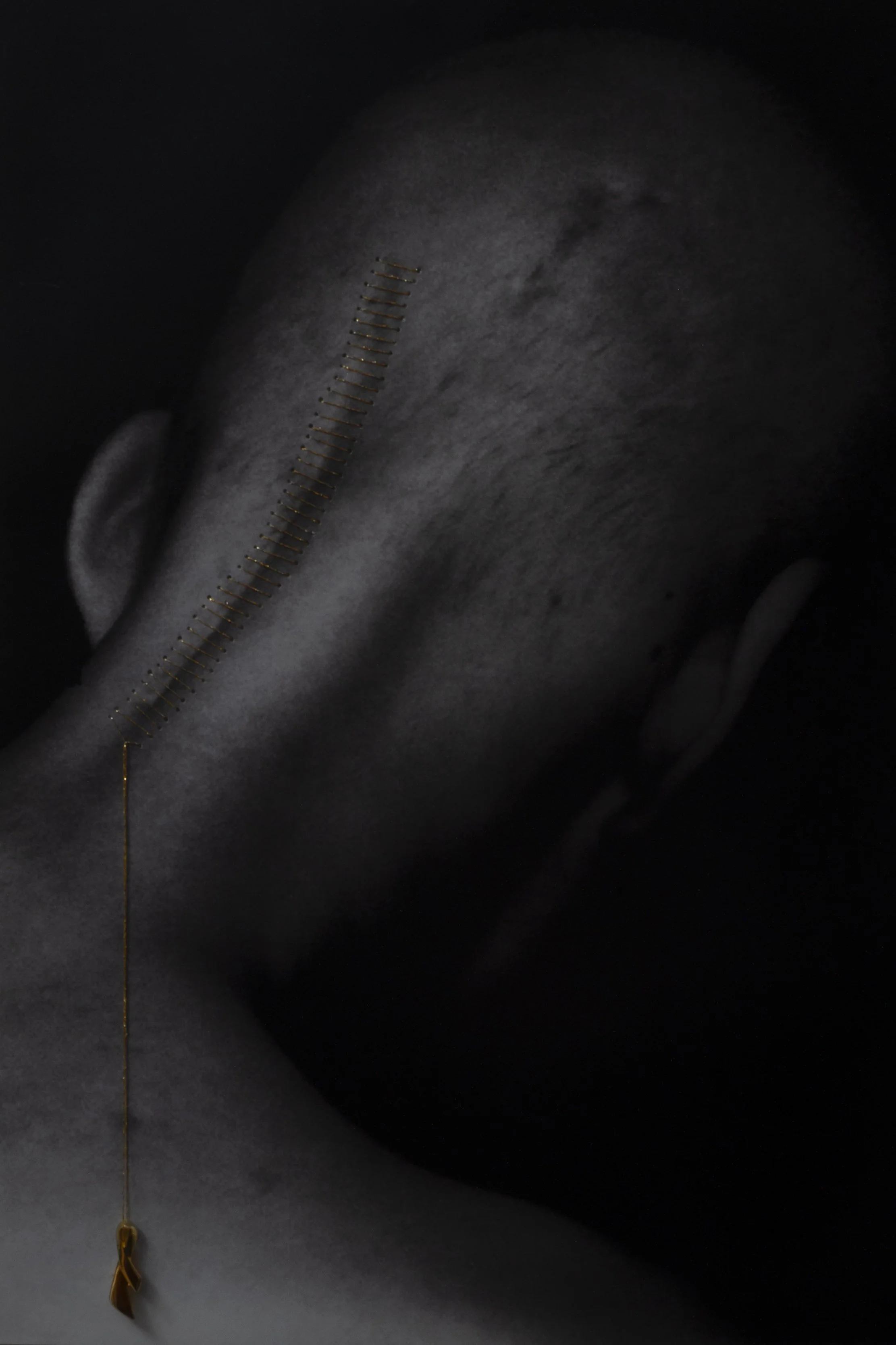 8. Hope
Some scars are visible and some are not.


