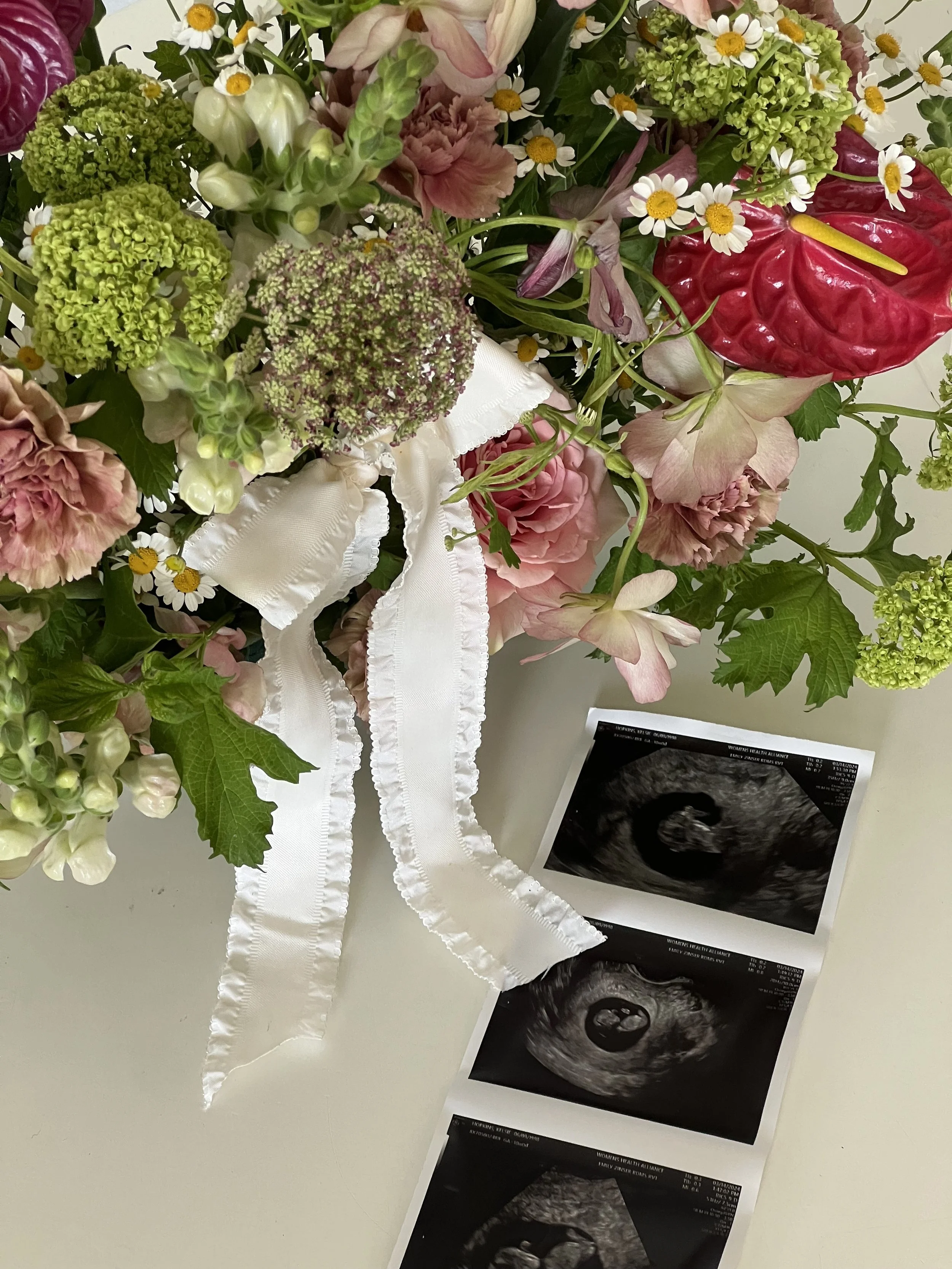 A bouquet of colorful flowers with a white ribbon next to three ultrasound photos on a light surface.