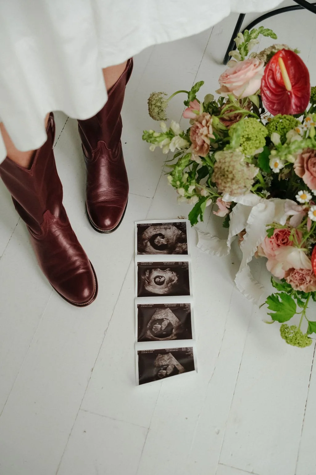 Person in brown boots and white dress standing next to flower arrangement and four ultrasound images on the floor.