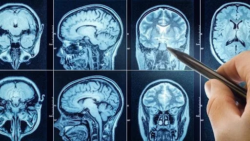 Can Neurofeedback Help with Chronic Pain? 