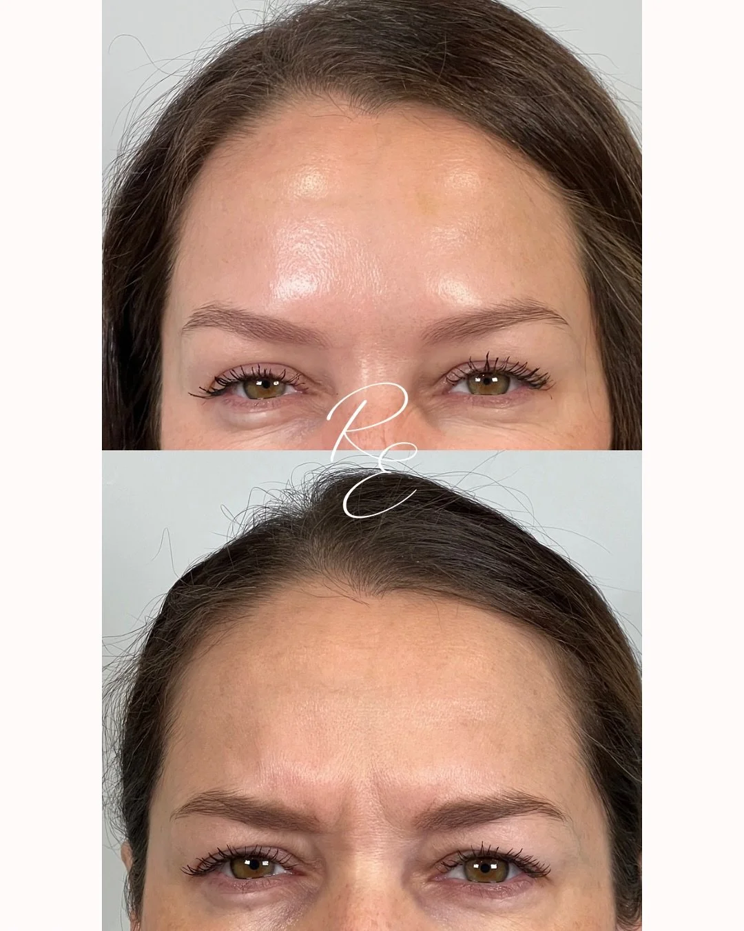 ✨7 Day Difference ✨ 
The Power of peptides with @daxxify!
We love long lasting natural results. If you want to achieve these same results, mark your calendar for November 6th and join us for our in house event with @revance 
There will be discount