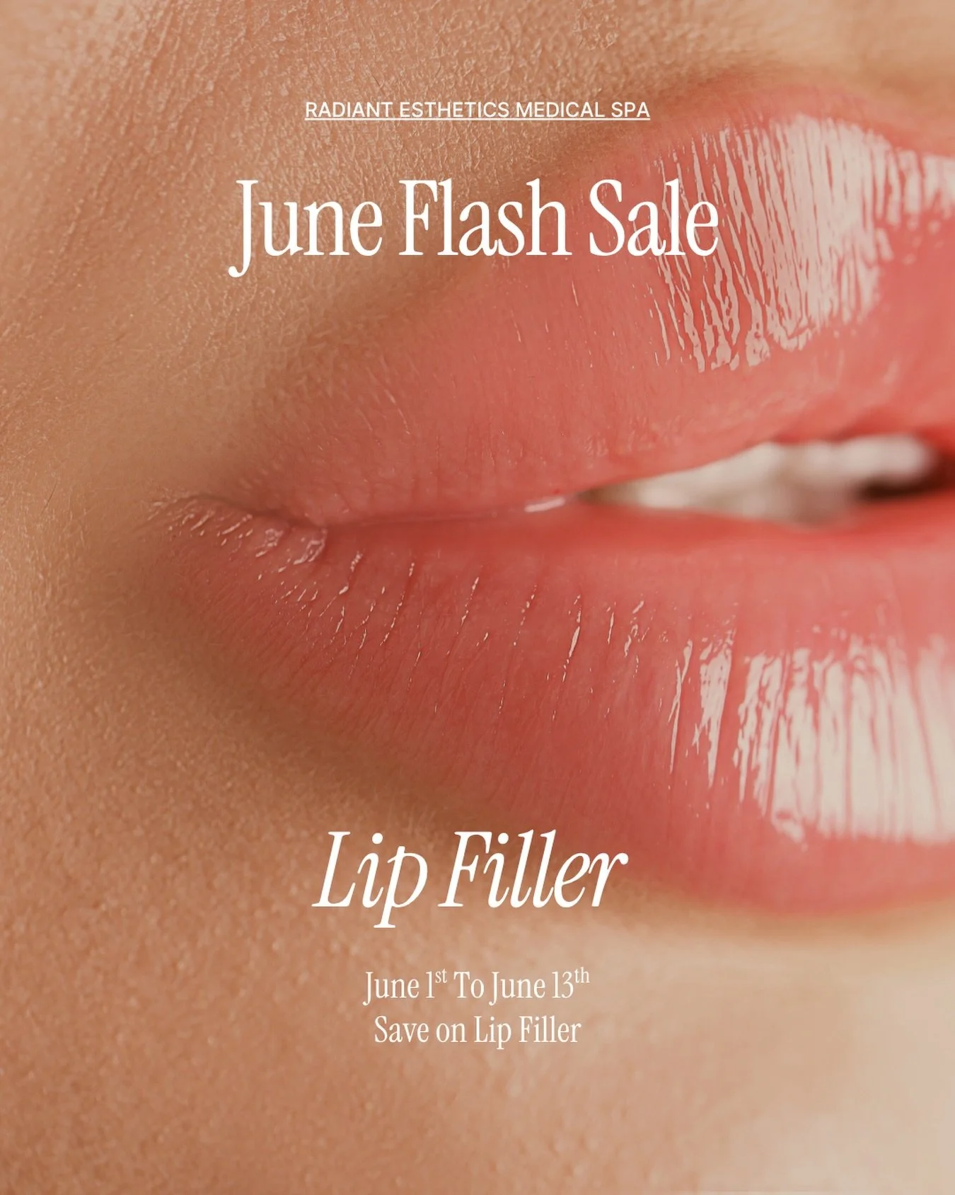 This summer&rsquo;s best accessory: A perfect pout👄

✨For a limited time, enjoy $150 OFF lip filler and get the pout you&rsquo;ve been dreaming of✨

This special can be purchased from June 1st to June 13th by calling us at 401-848-0022 or purchasing