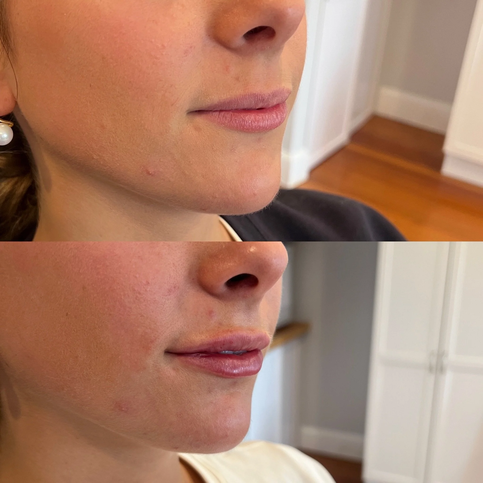 Summer glow up is calling ..👄

Starting today until June 13th, save $150 on lip filler with our ✨ June Flash Sale ✨

Book your appointment through June 13th or call to save this deal in your account. Appointment must be scheduled by the end of augus
