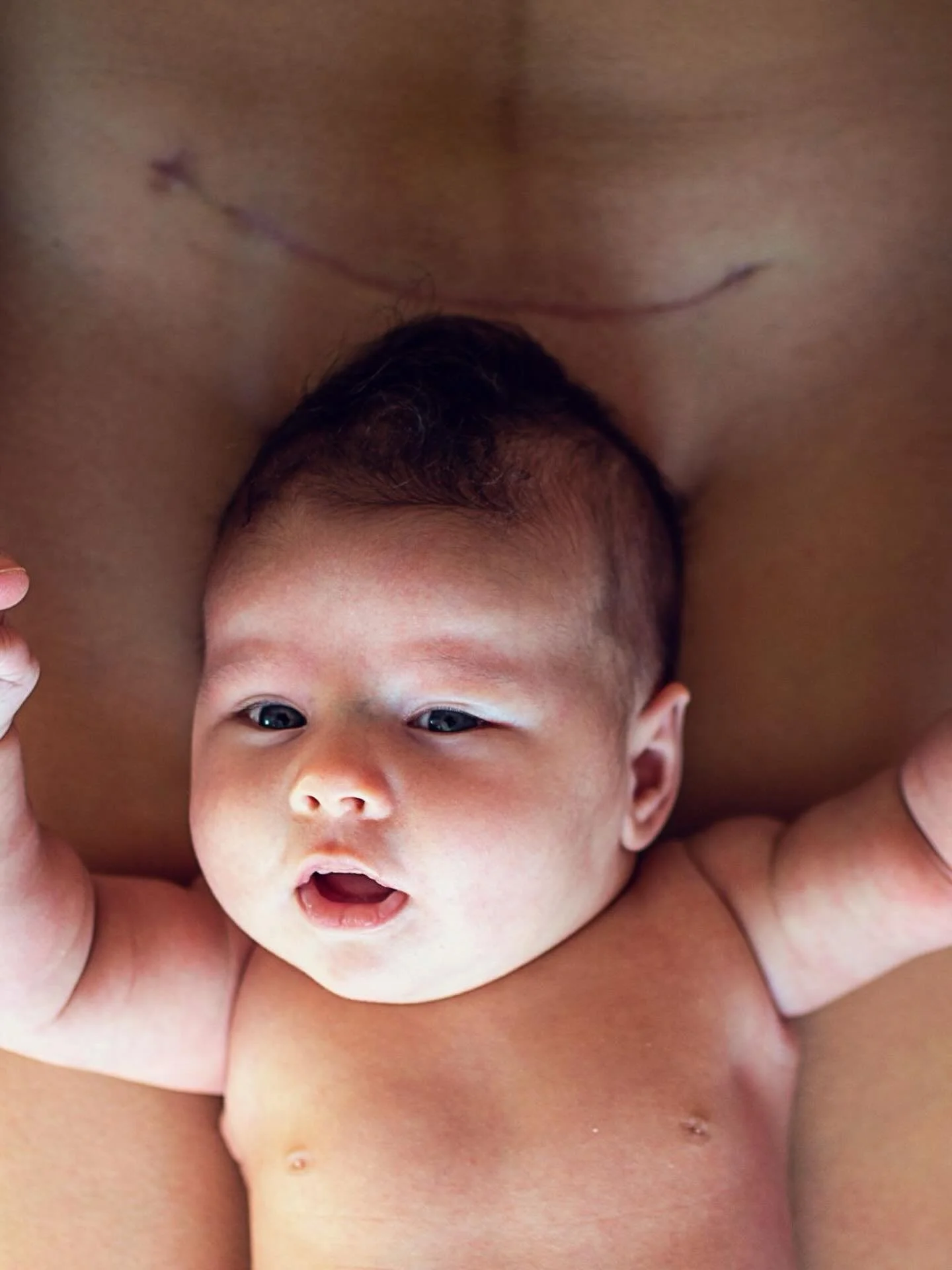 After a C-section, your abdominal muscles are healing from surgery.

When they&rsquo;re strained too early, even simple movements can feel painful.

Shifting strength to your arms instead of your core by using Support To Rise helps to protect your he