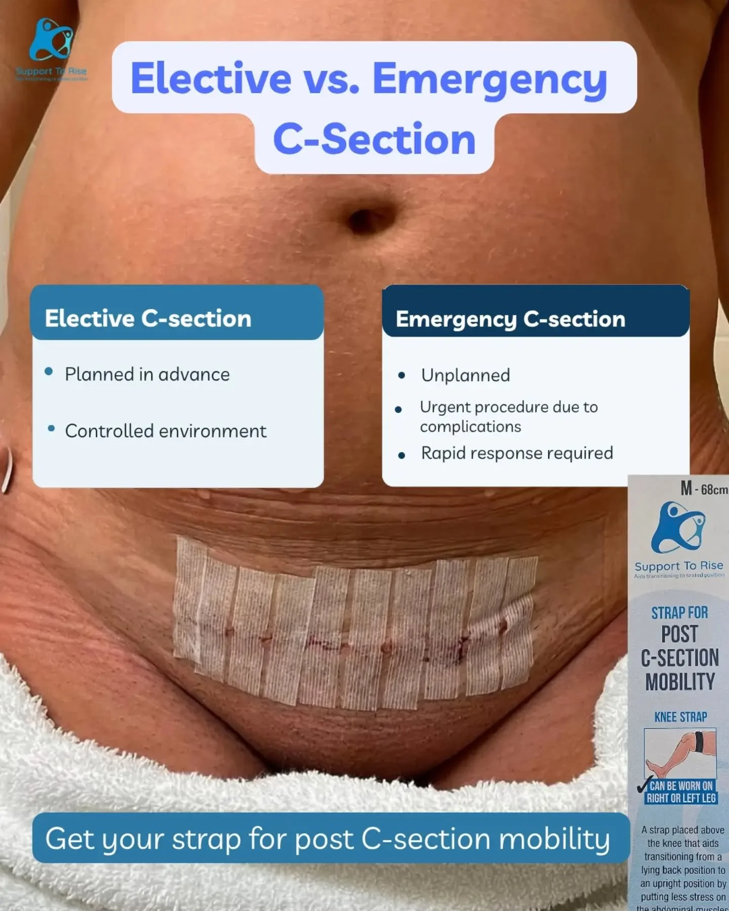 Get your strap for post c-section mobility. This strap will help you rise up post c-section with less stress on your abdominal muscles.

Available at www.supporttorise.ie

#csection #csectionrecovery #postpartum #emergencycsection #electivecsection