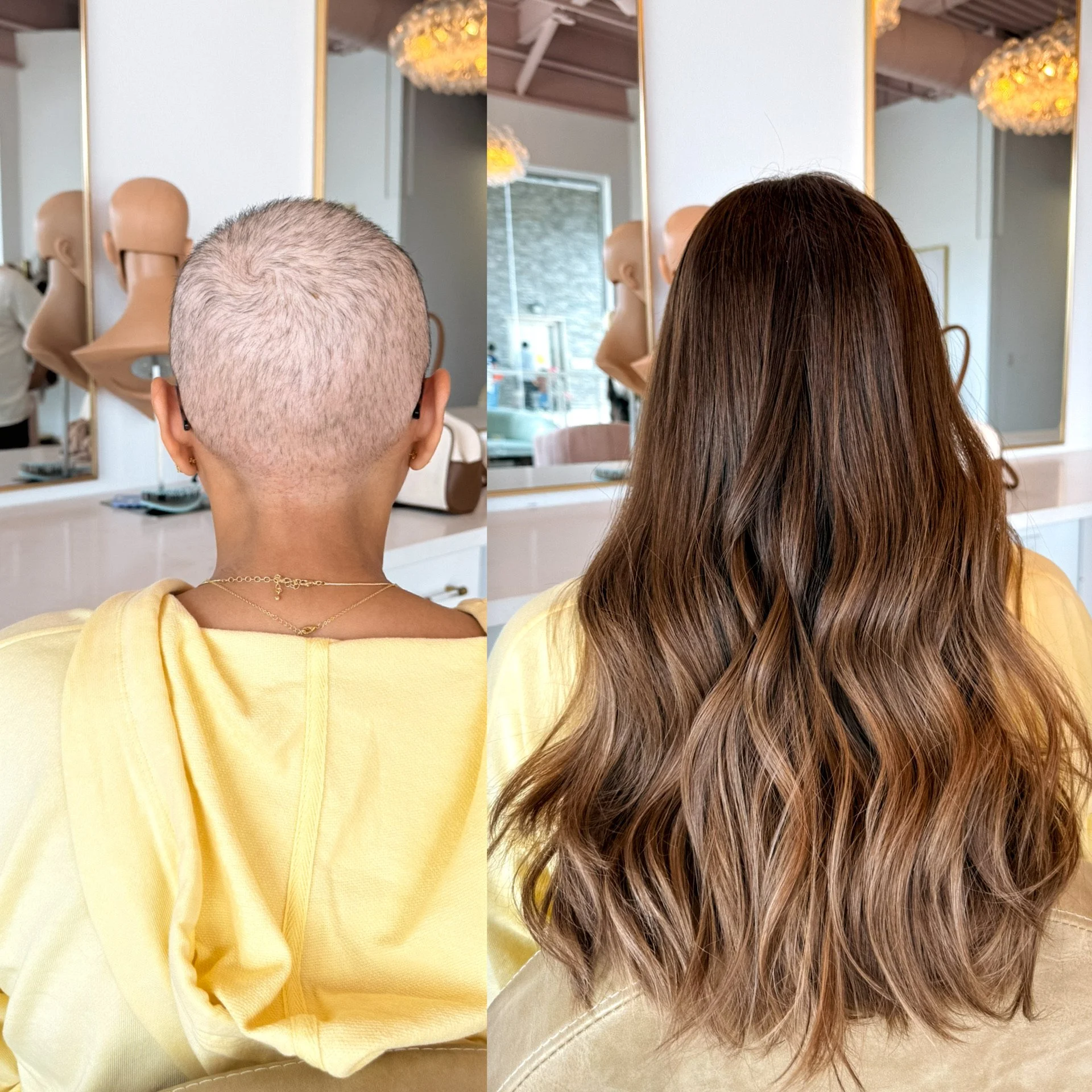 Getting Insurance to cover your wig.