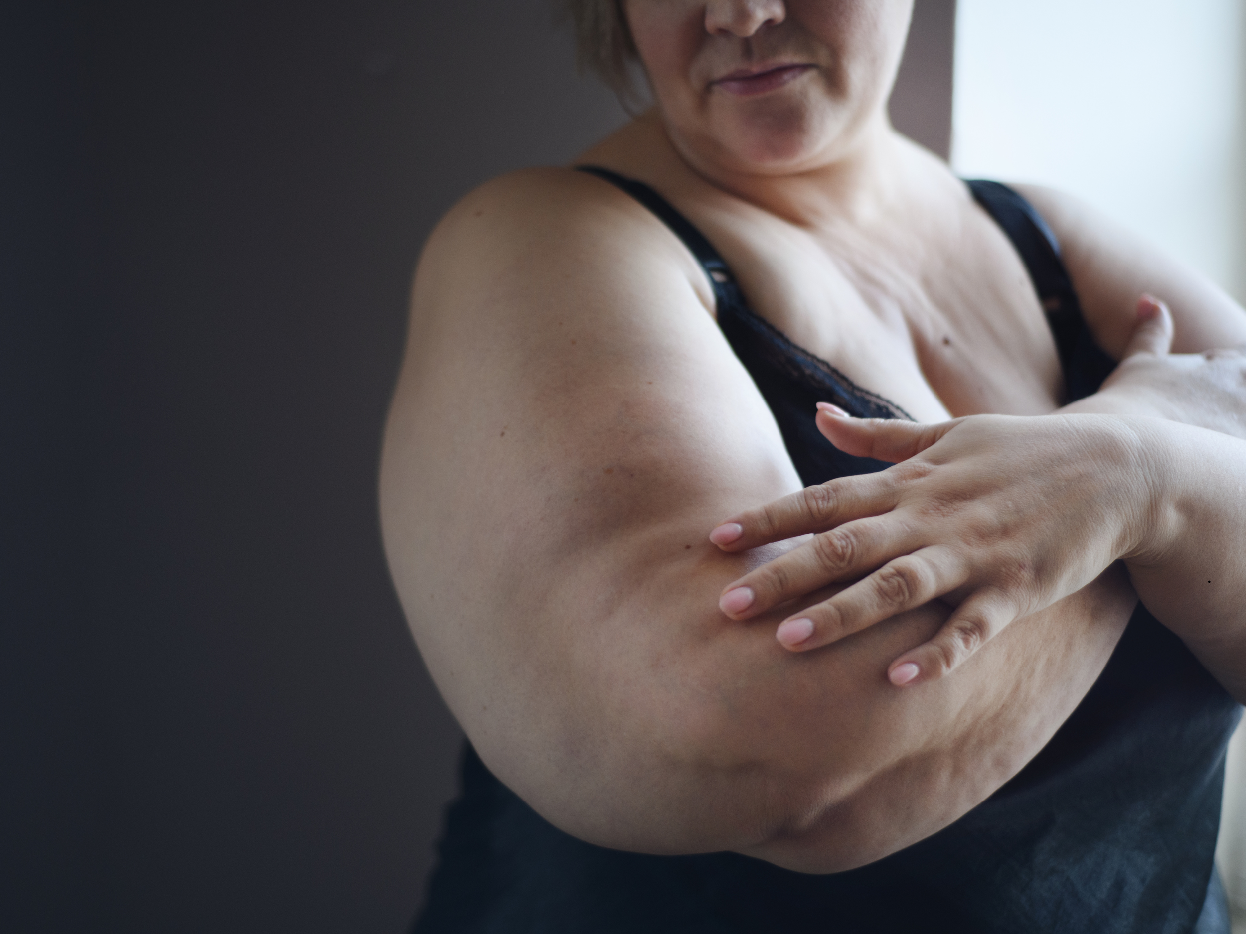 A person in a black tank top warmly touching their arm.