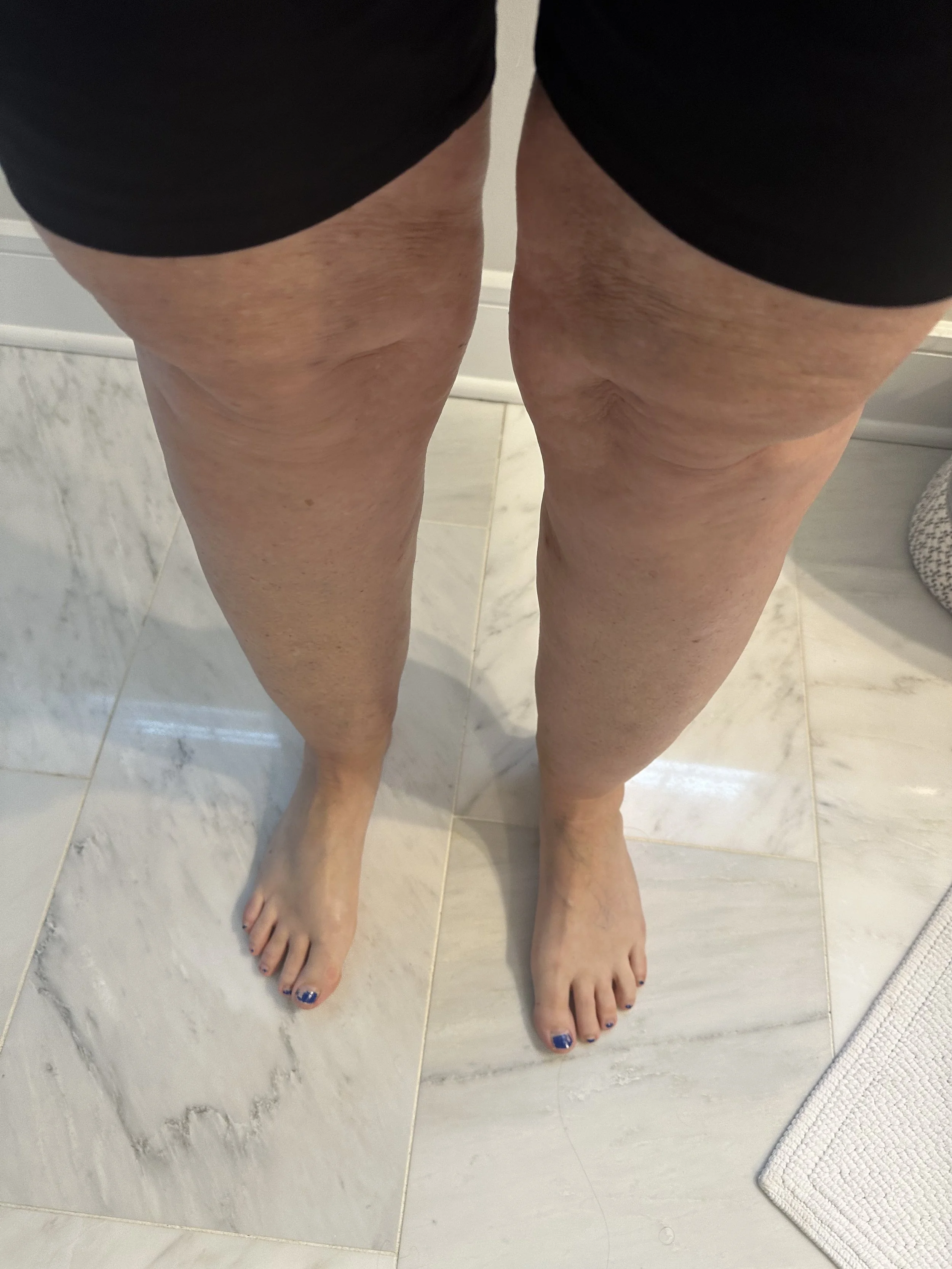 Person's legs and feet on marble tile floor, wearing black shorts, with blue nail polish on toenails.