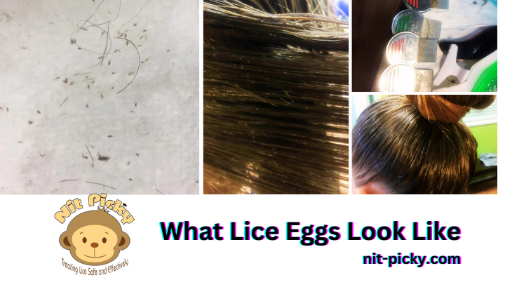 lice eggs on a paper towel. A long hair girl with nits in her hair, nits on lice combs, and finished clean hair.