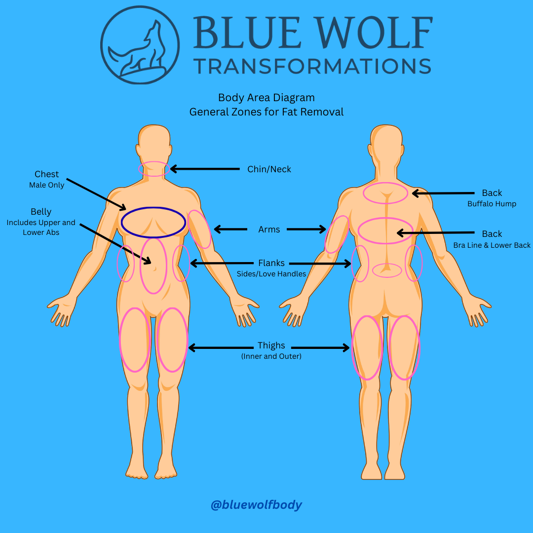 Body Area Diagram.png