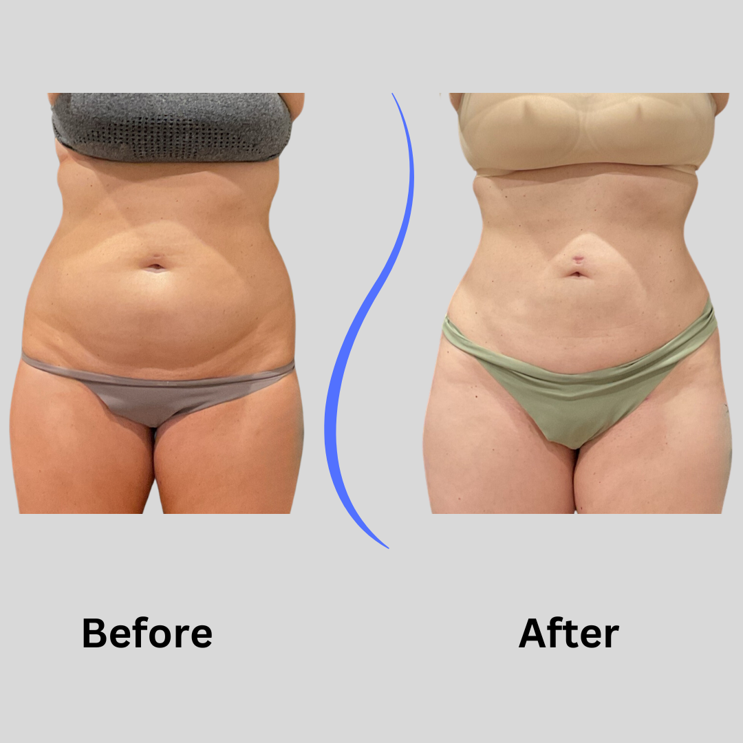 website kl 360 before after.png