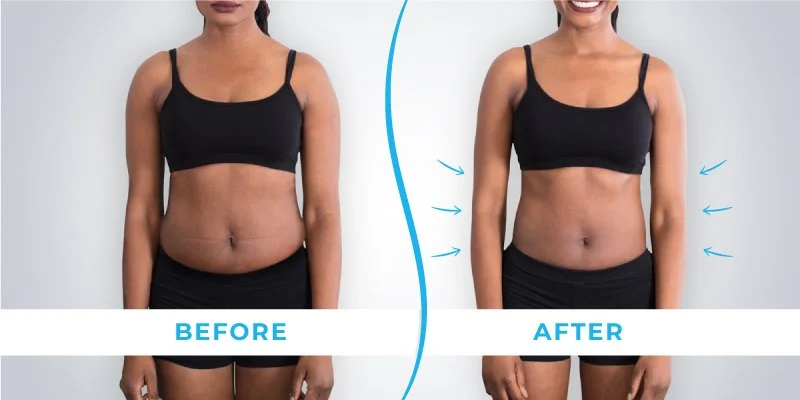 Belly Fat Removal — Blue Wolf Transformations