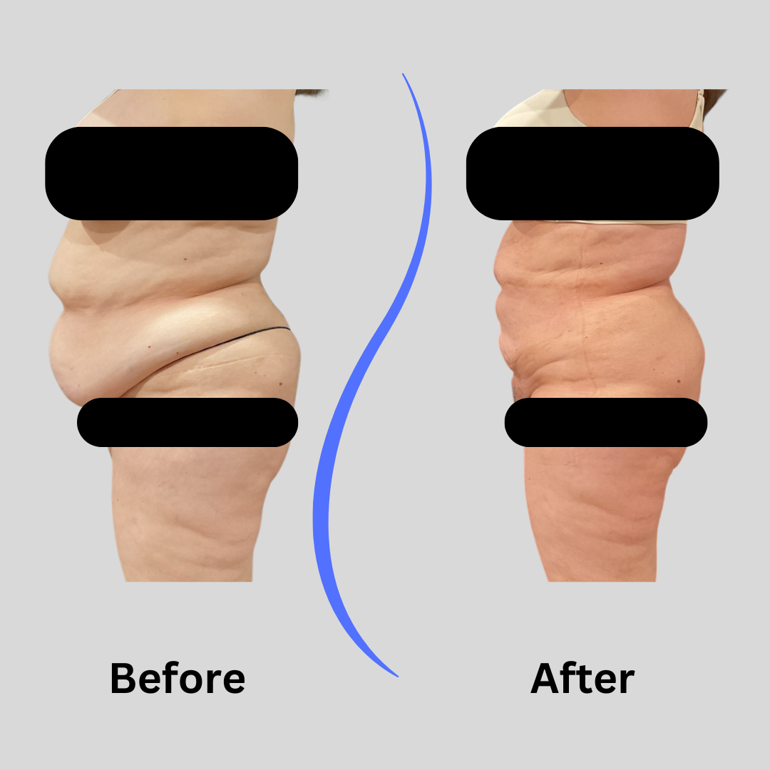 website AS side before after (1).png