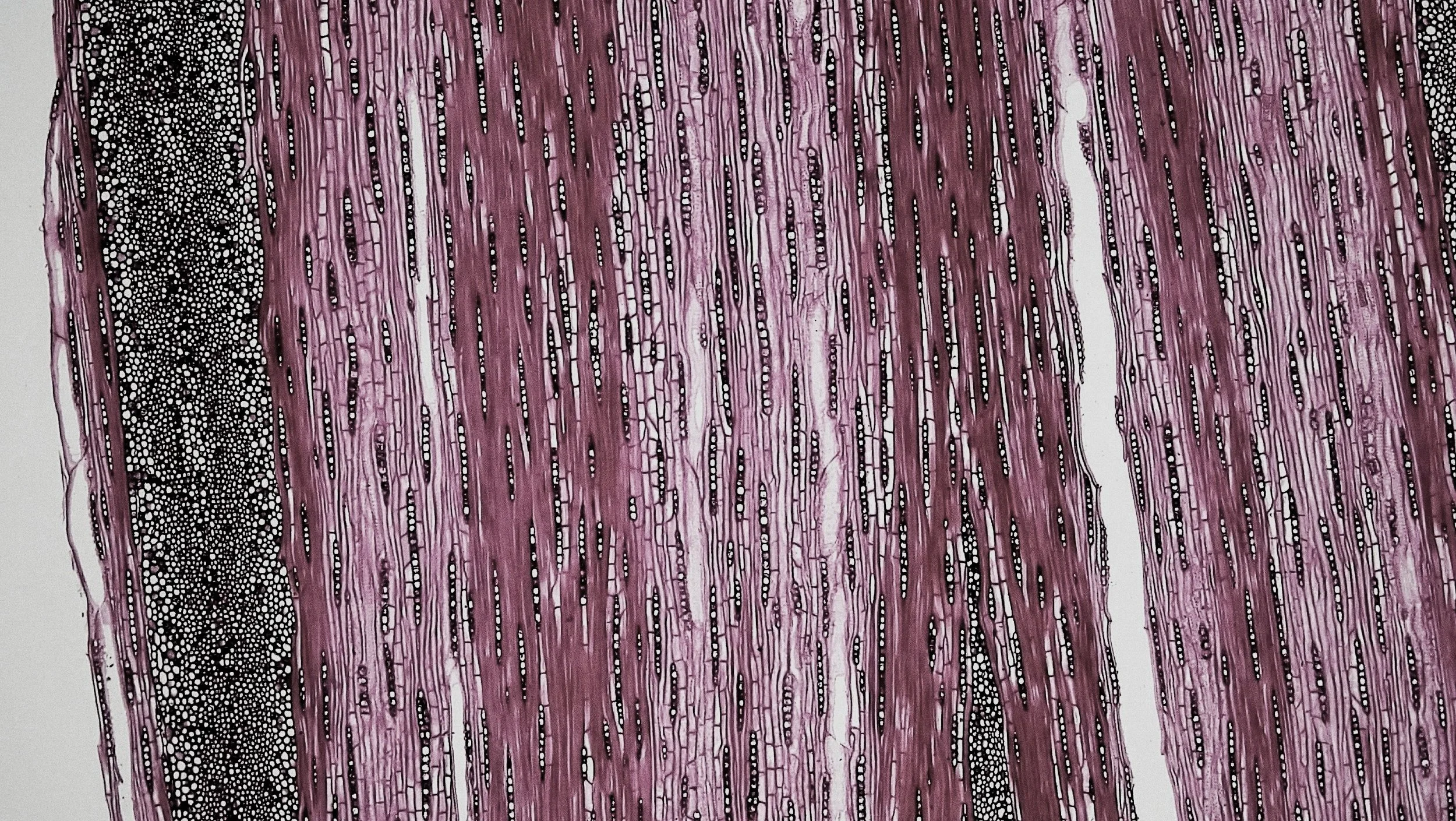 pink black and white painting of brain neurons representing the psychobiological approach to couple therapy