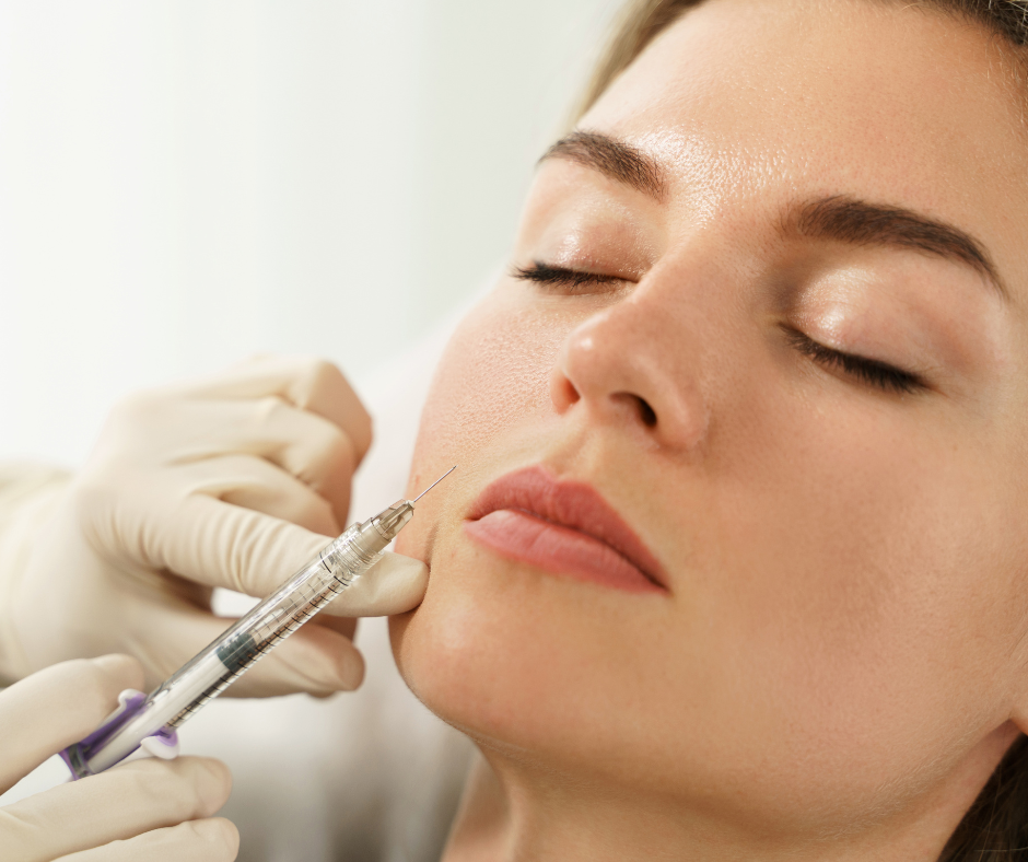 Lip Fillers in Encino, CA 91436 | Skin Protocol Medspa