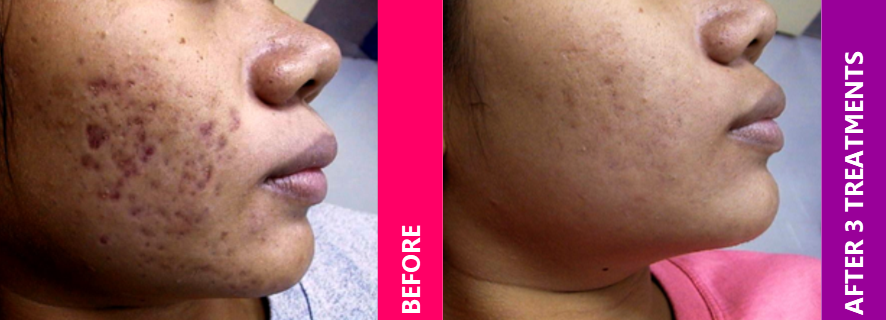 Skin Protocol Medspa Services