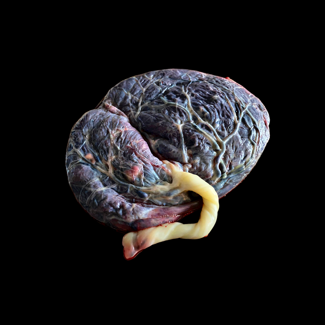 2A474782-6B2B-4794-AE00-3461B6EFA5F8.png
