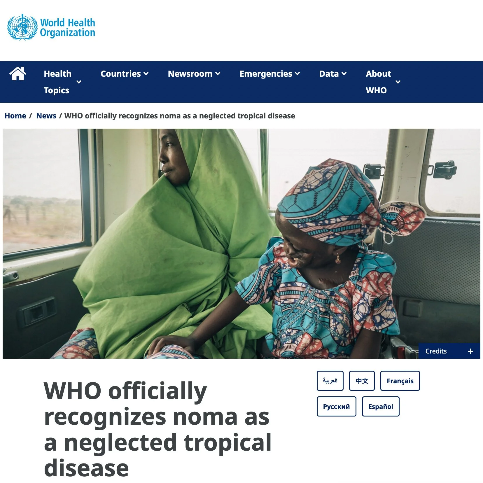 WHO officially recognizes noma as a neglected tropical disease