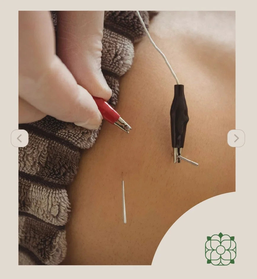 OscarPunter-Web-Acupuntura-02.jpg