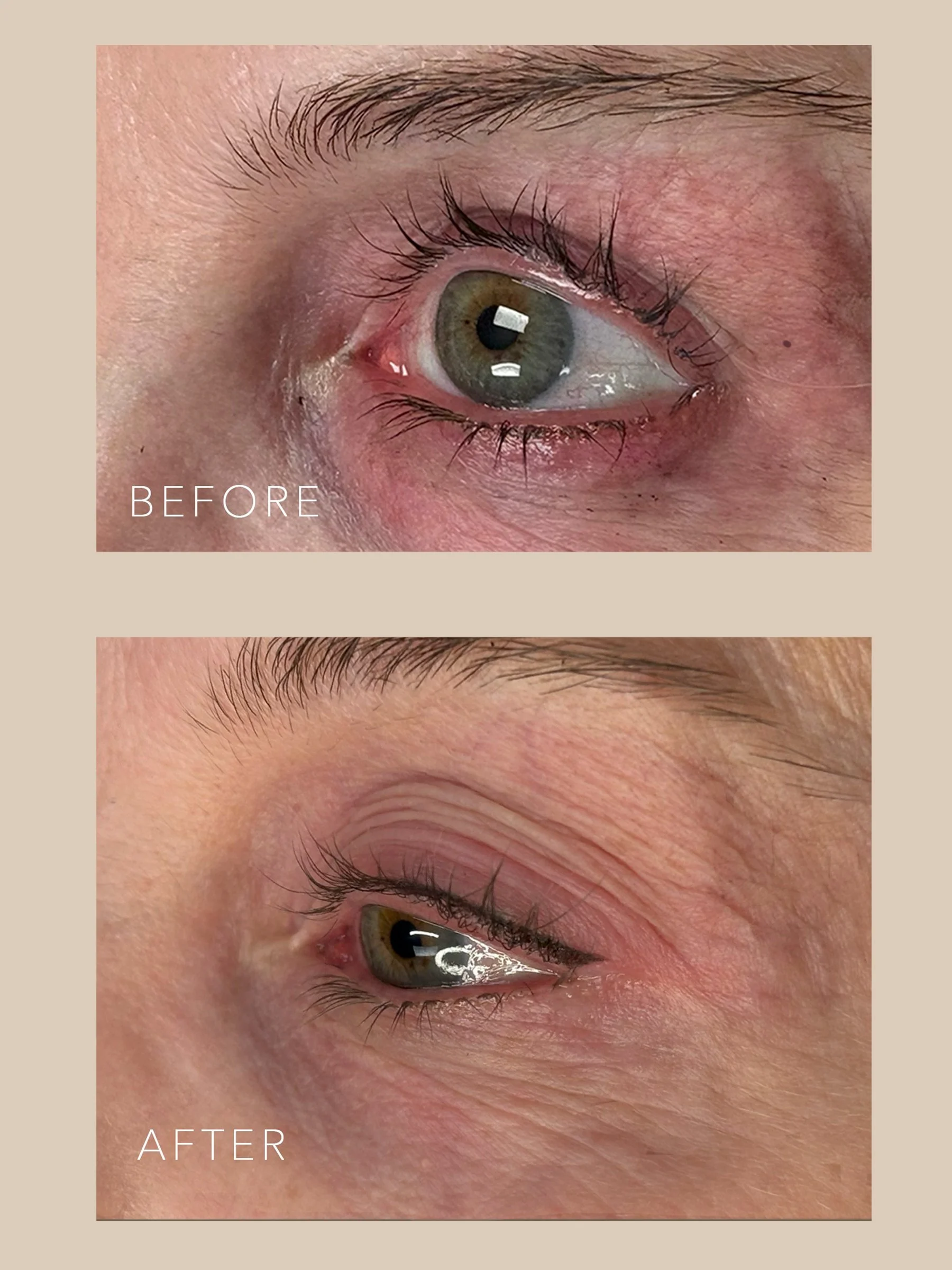 Close-up of a person's eye before and after an eyelash extension treatment, showing the difference in lash fullness and length.