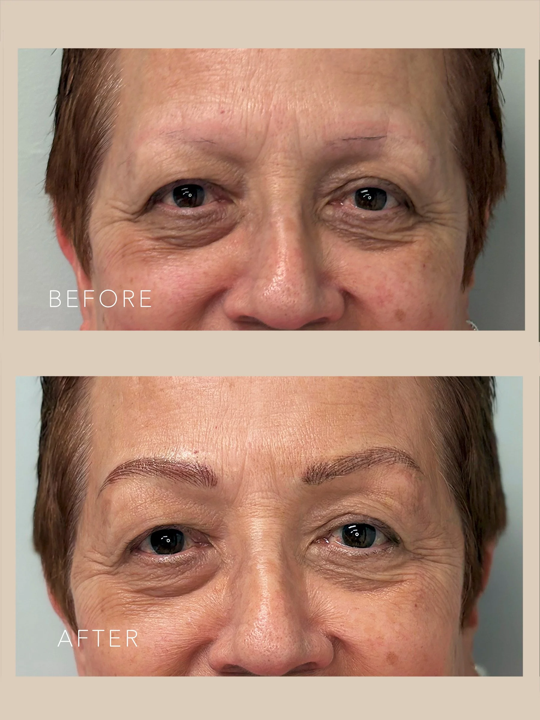 Before and after images of a person's face showing cosmetic eyebrow enhancement, with the top labeled 'BEFORE' showing sparse eyebrows and the bottom labeled 'AFTER' showing fuller, more defined eyebrows.