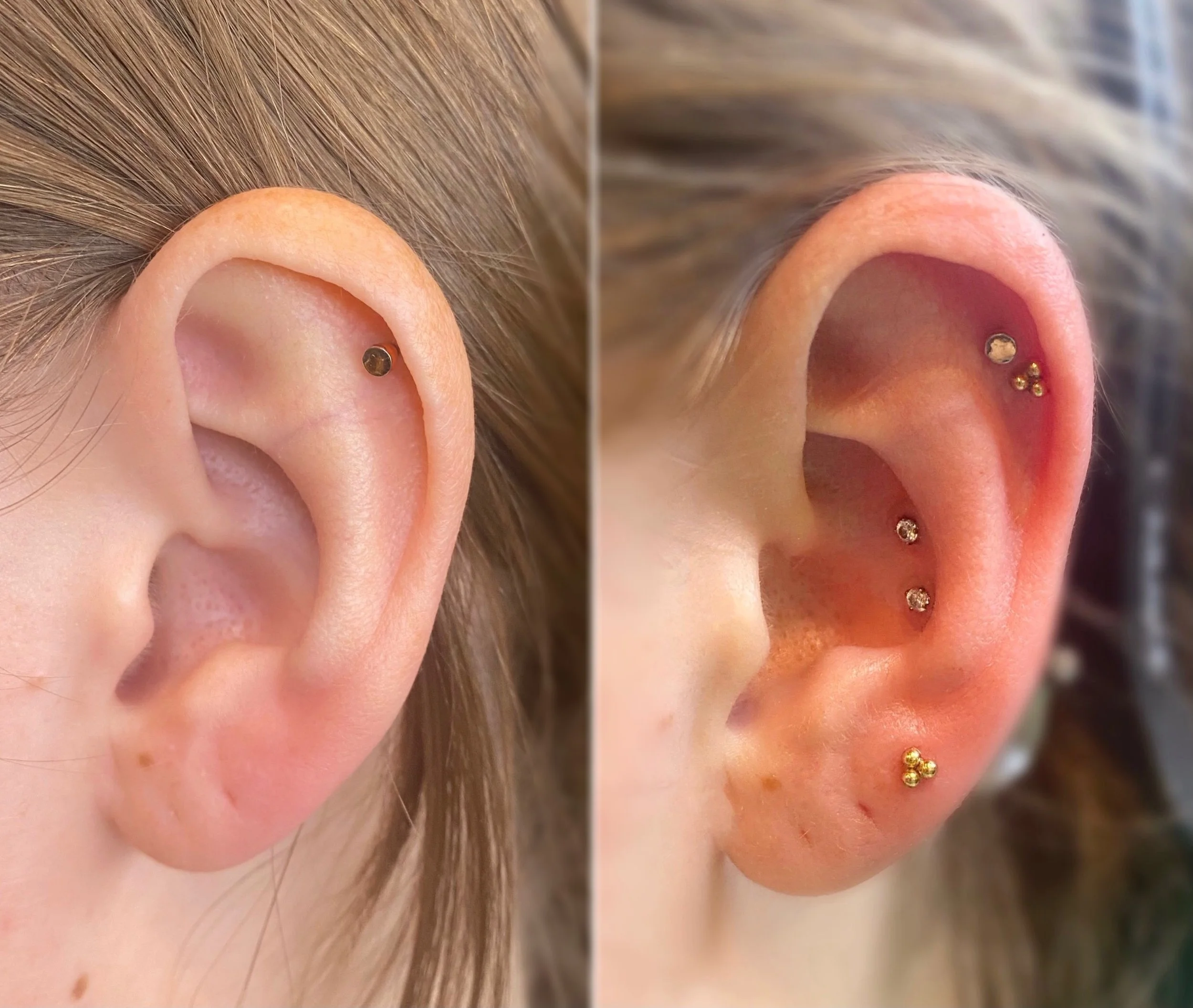 Ear curation 
