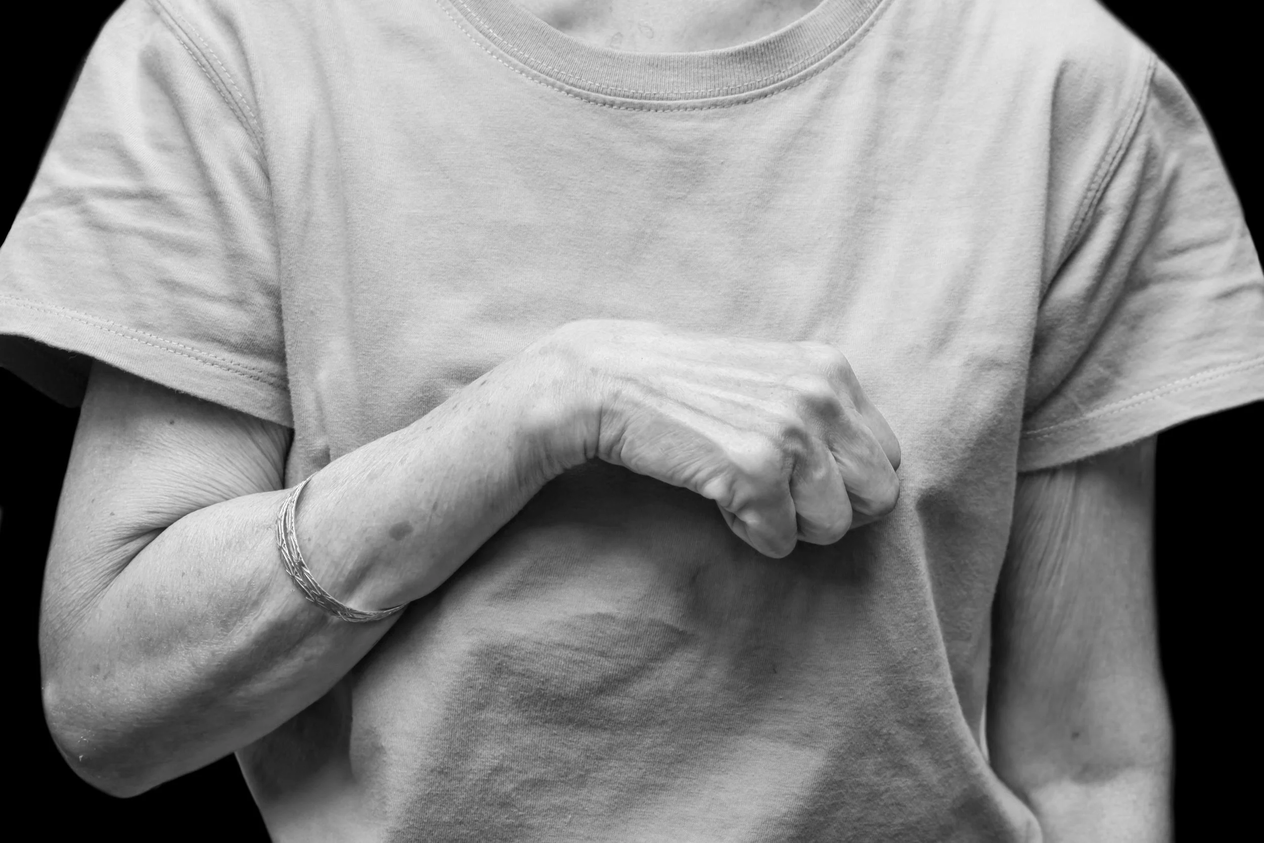 Chirurgie des séquelles des pathologies neurologiques centrales