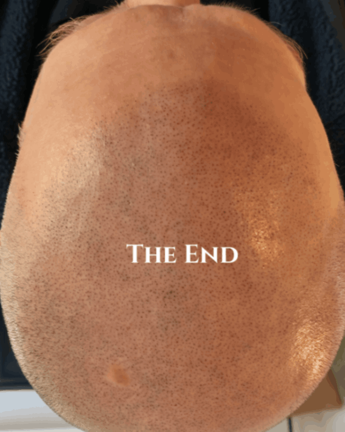 The End Of SMP