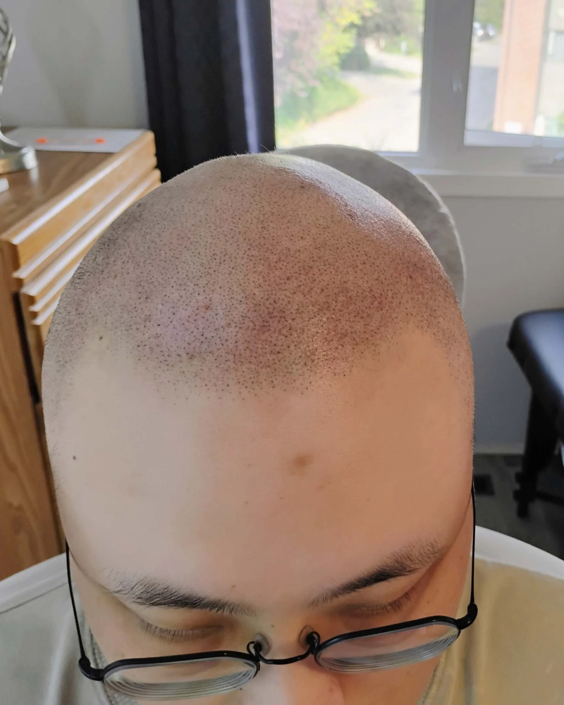 SMP on a Korean client