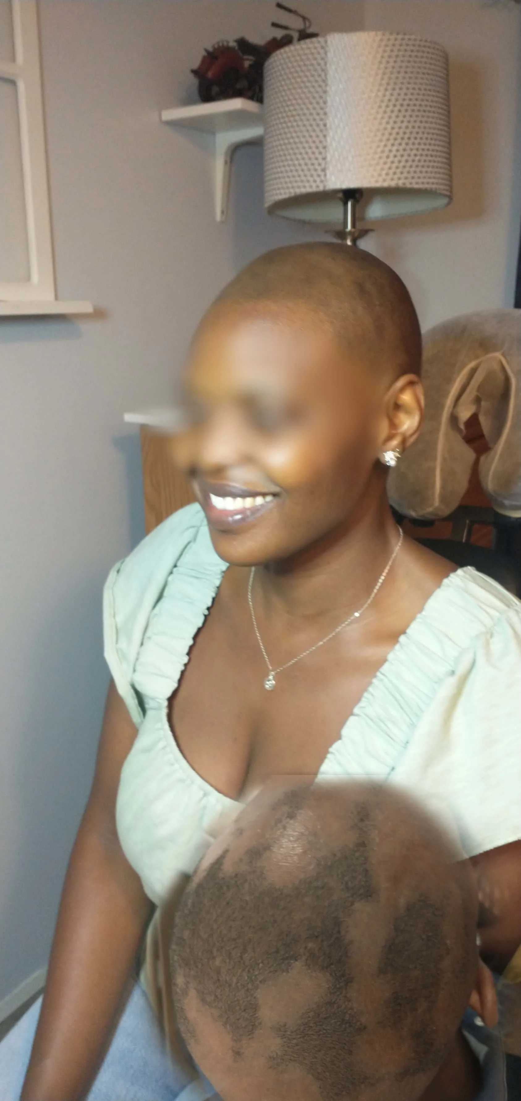 Happy client after SMP fixing her severe Alopecia