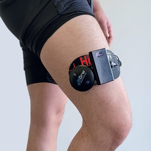 Heated-Electrode-Pad-Placement-5.jpeg