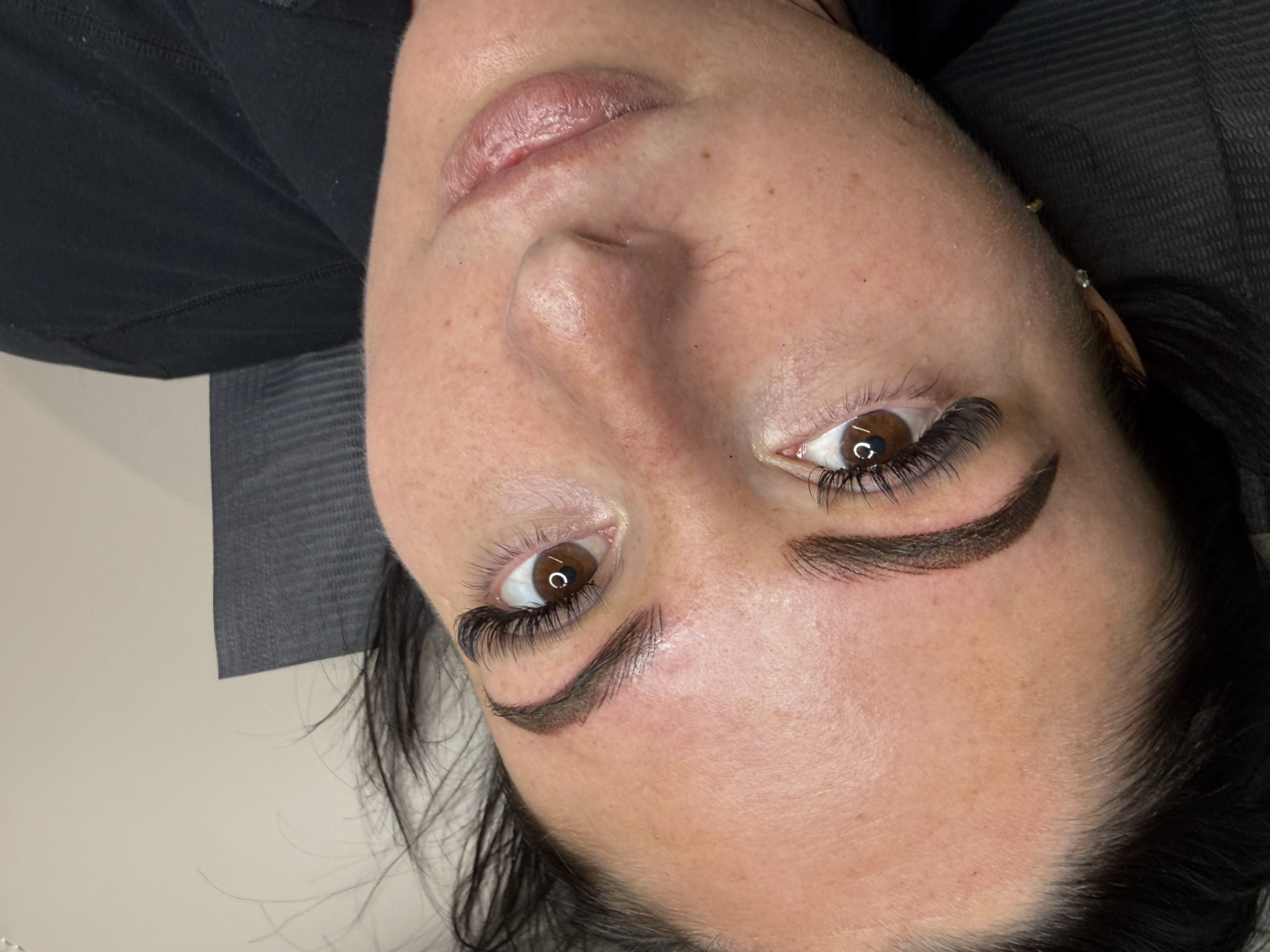 brow correction