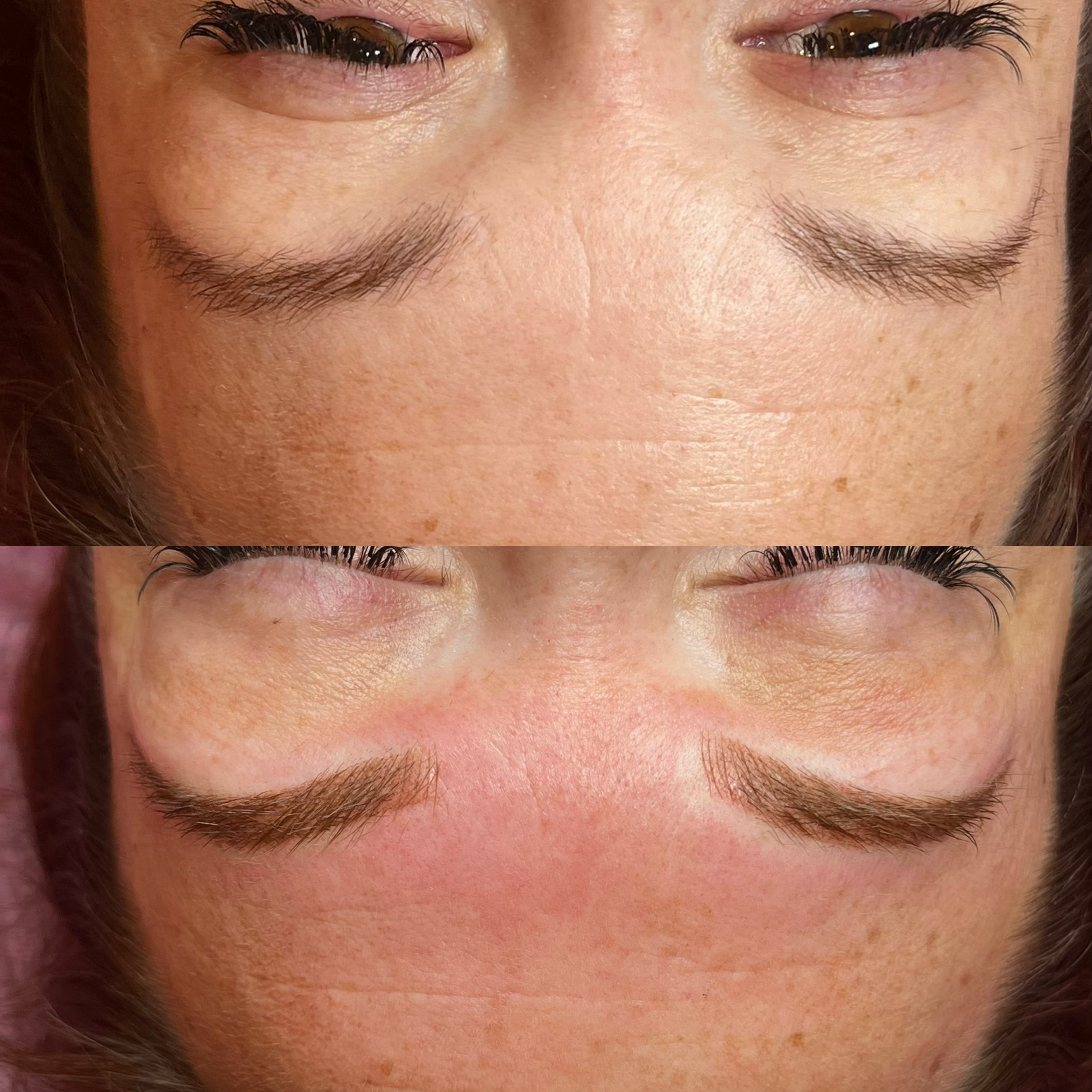 Before & After Combo Brow