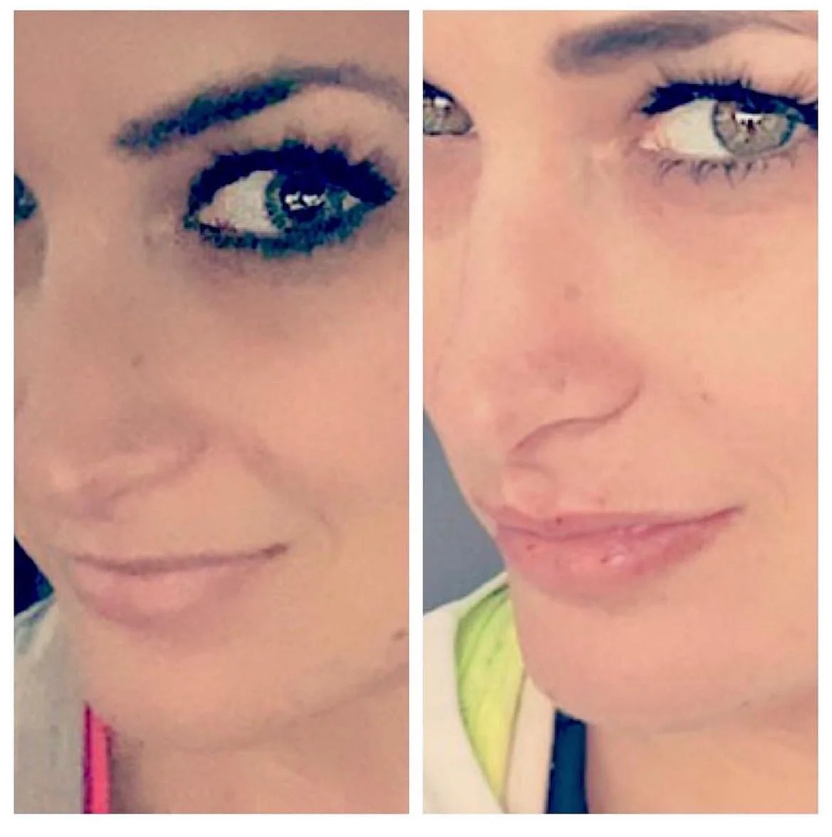 Lani Before and After 2.jpg