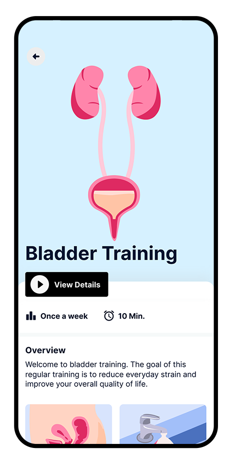 Bladder_Mockup.png