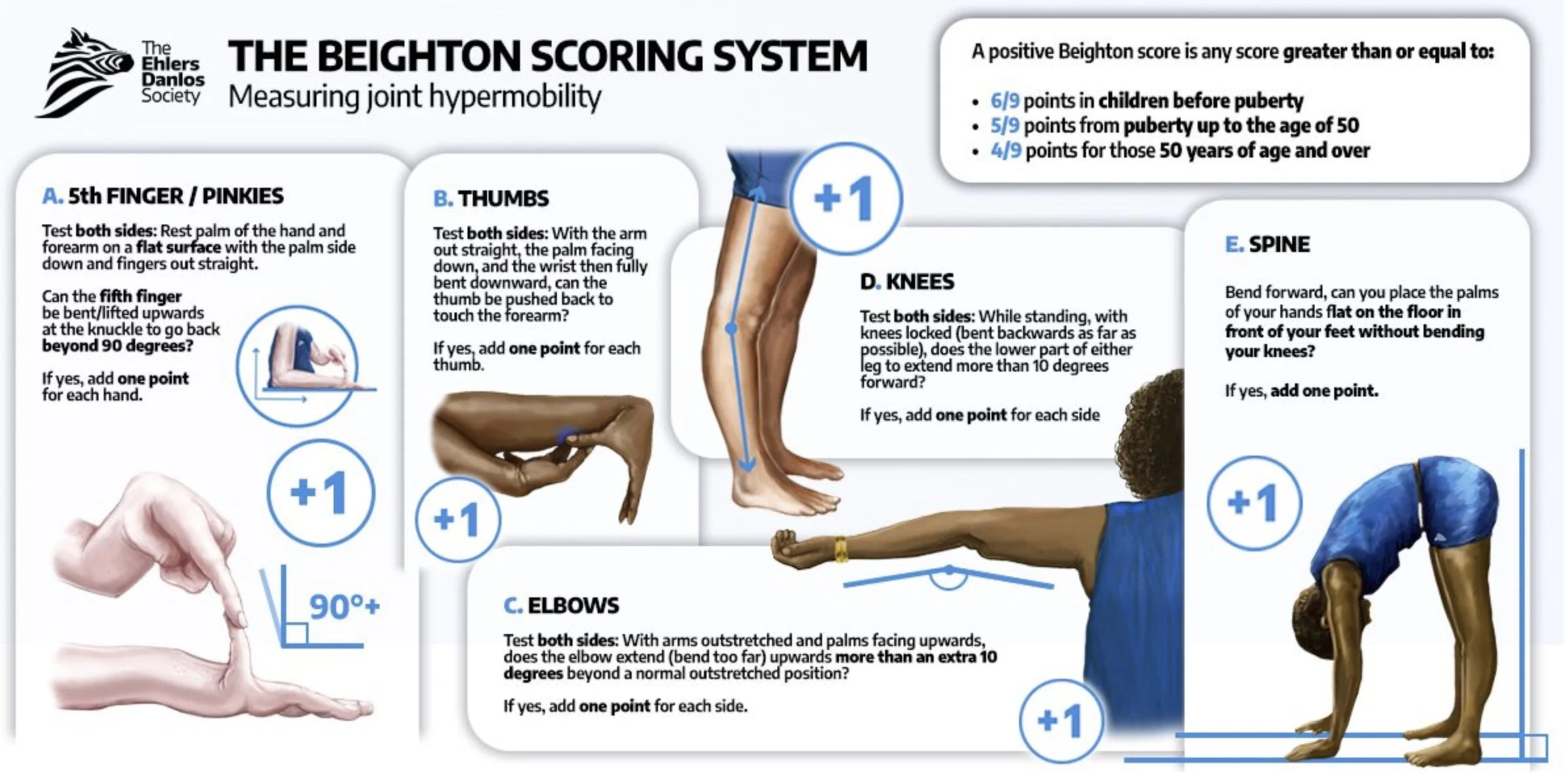Infographic describing a 9 pt scoring system looking for hypermobility