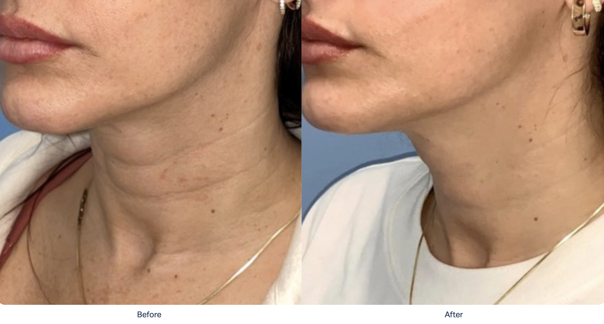 Screenshot 2025-12-08 at 11.10.25 PM.png