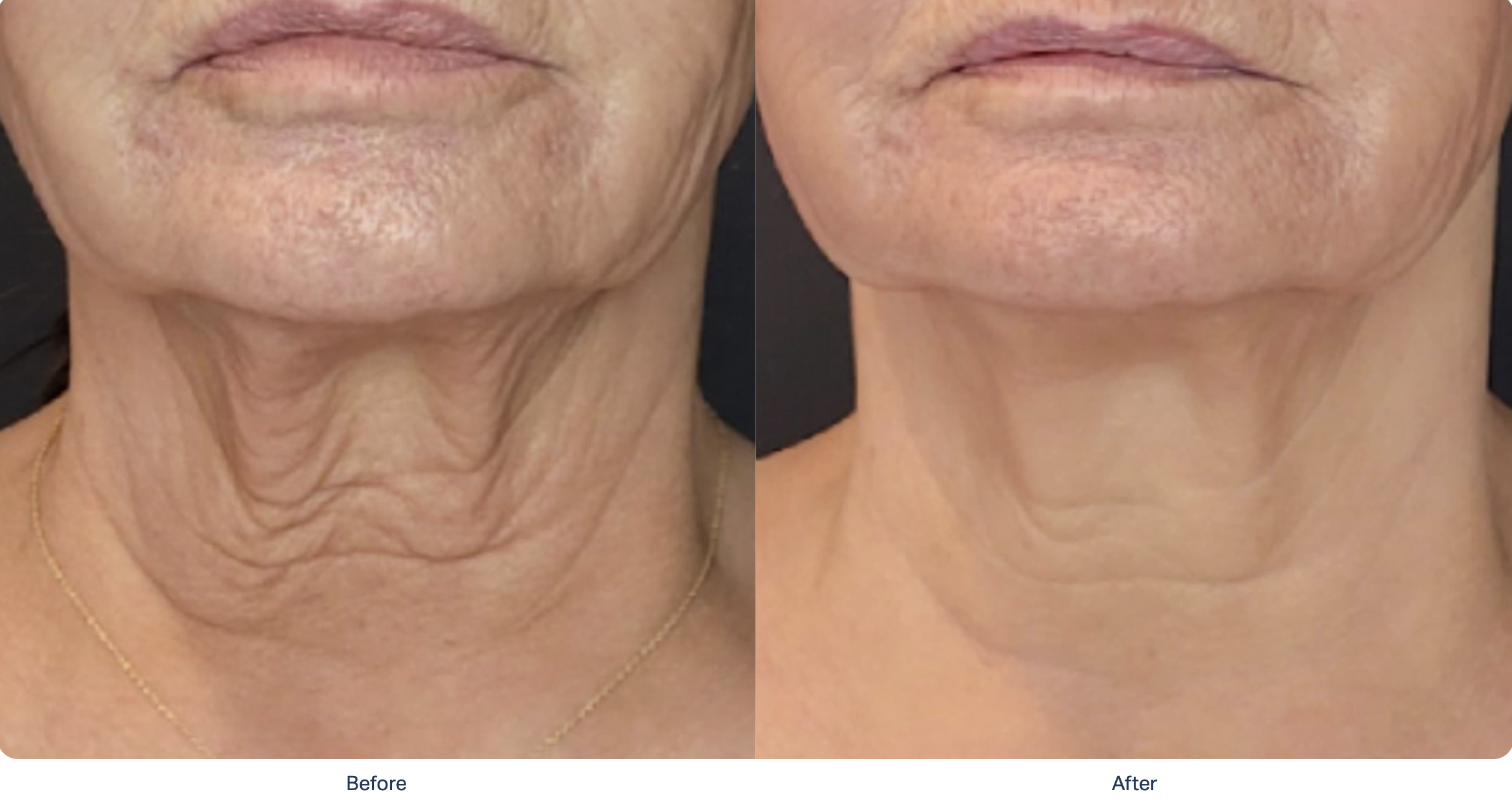 Screenshot 2025-12-08 at 11.08.51 PM.png