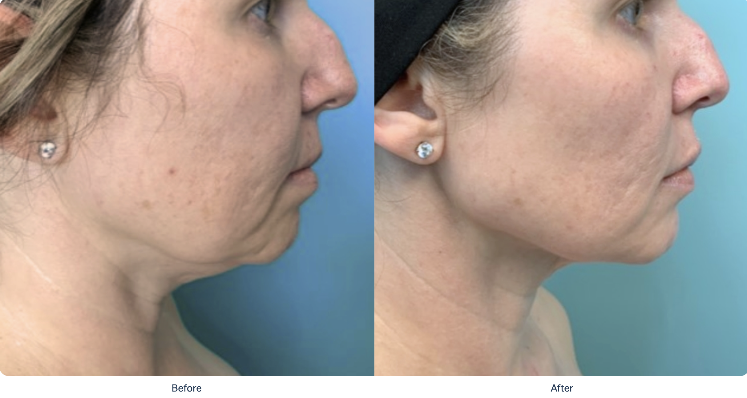 Screenshot 2025-12-08 at 11.13.22 PM.png