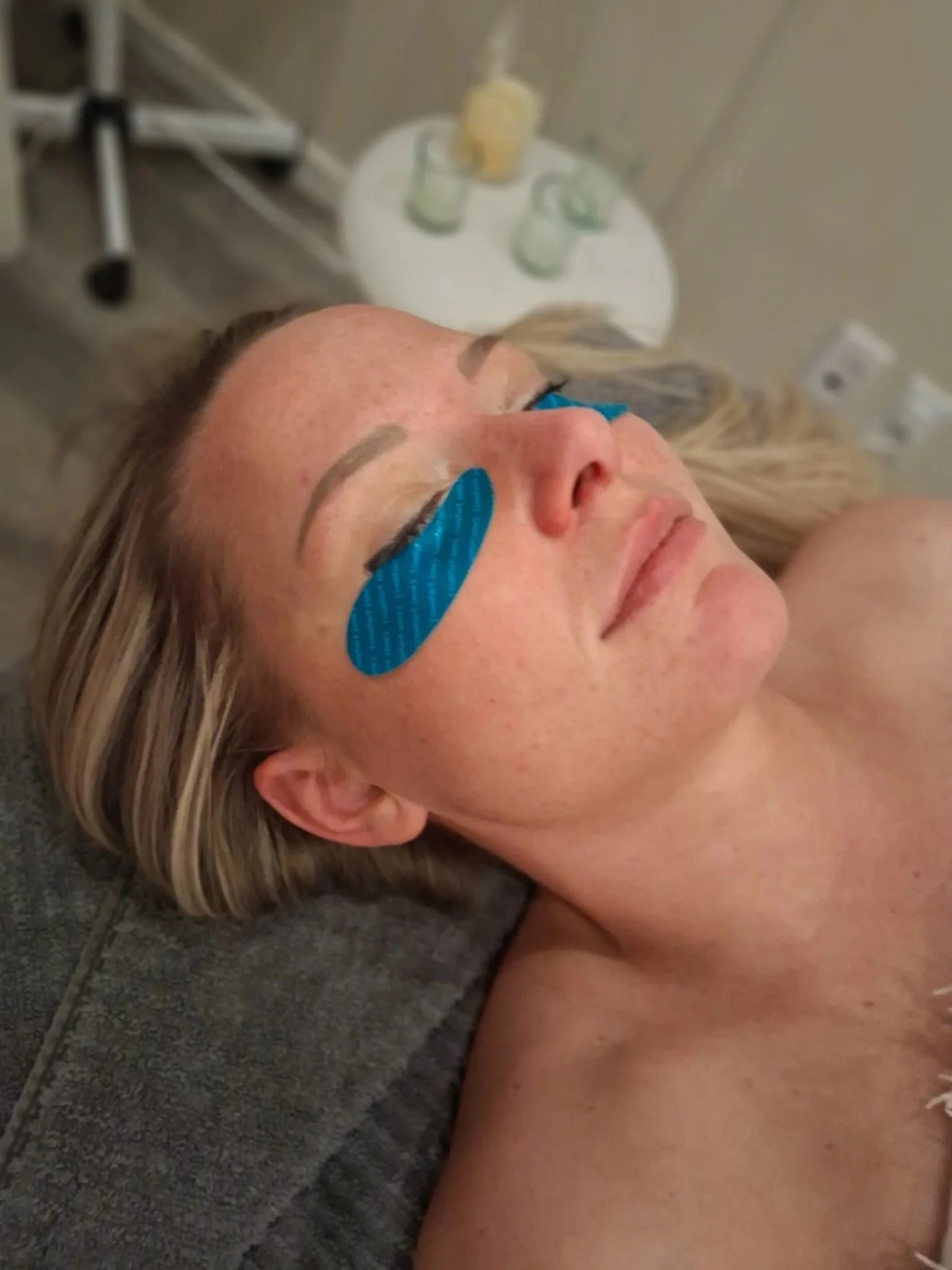 Woman with blue eye patches under her eyes, relaxing as he experiences an eye recovery add on treatment