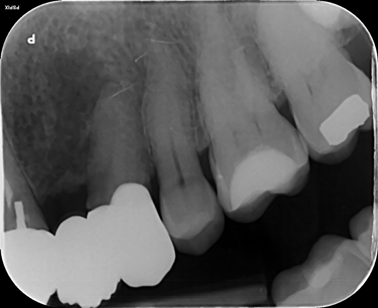 Swelling beneath bridge.jpg