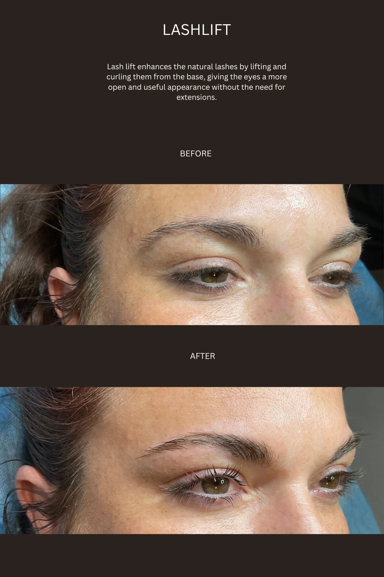 LASH LIFT