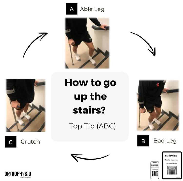 How to Complete Stairs Safely After a Hip or Knee Replacement ...